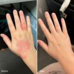 Kräm mot Hudinflammation & Hälsosam Hud – Lindrar klåda, rodnad och fjällning 50ml - Bild 9